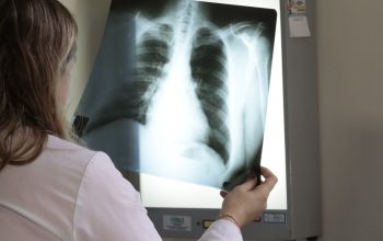 Ministério da Saúde destaca Joinville por atuação no tratamento da tuberculose