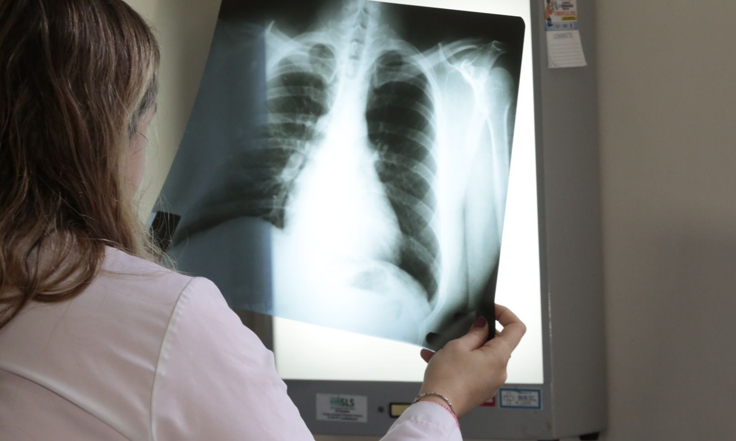 Ministério da Saúde destaca Joinville por atuação no tratamento da tuberculose
